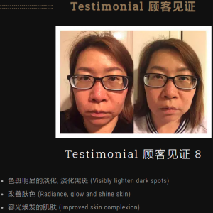 色斑明显的淡化, 淡化黑斑